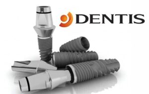 Дентальные имплантаты Dentis: виды и преимущества